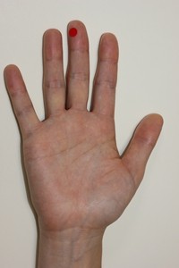 手の中の突発性難聴のツボの位置
